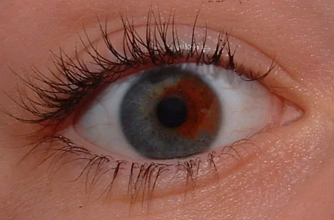 Los 8 colores de ojos más raros del mundo Los 8 colores de ojos más raros del mundo