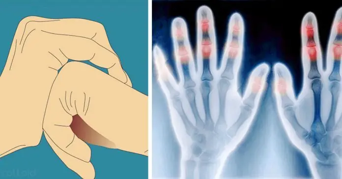 Esto es lo que realmente ocurre cuando te crujes los dedos