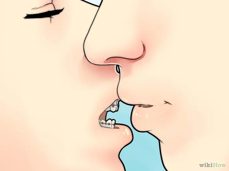 7 consejos para besar con brackets