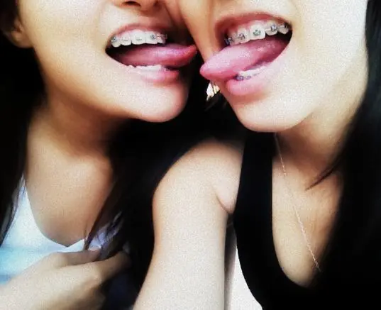 brackets