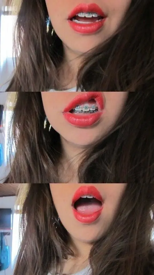 besos