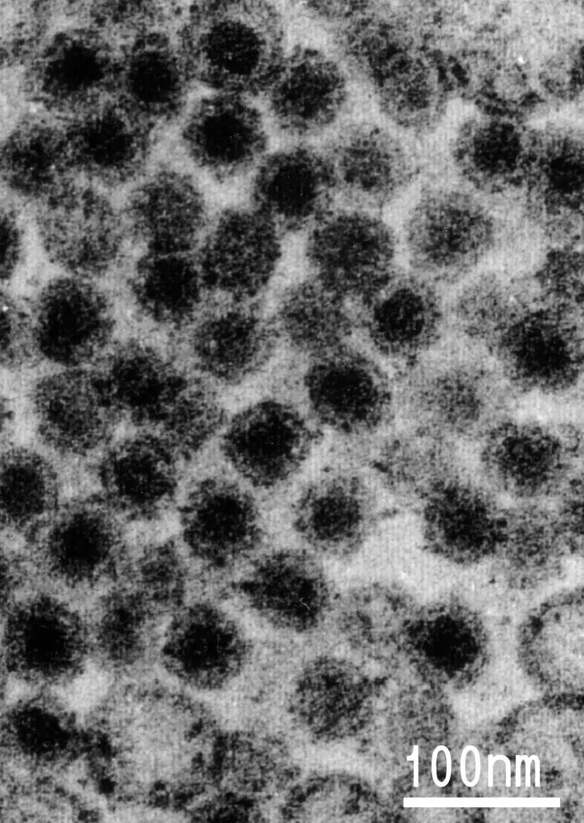 10 Virus mortales bajo el microscopio