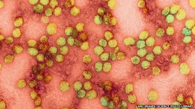 virus mortales