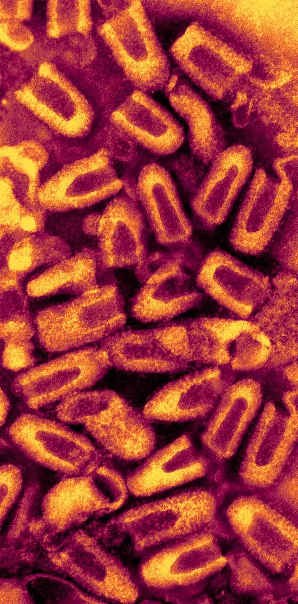 hantavirus