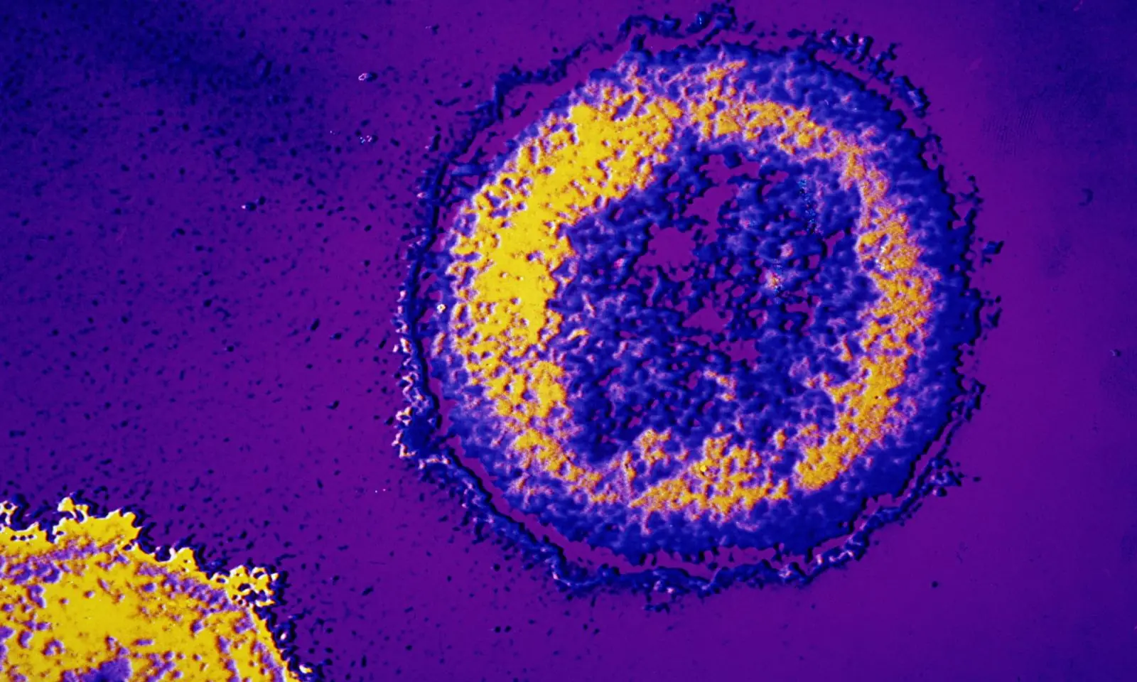 virus