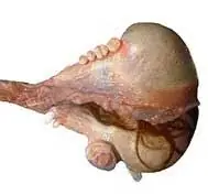 viejo