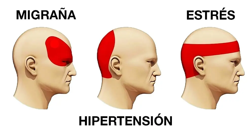 cabeza
