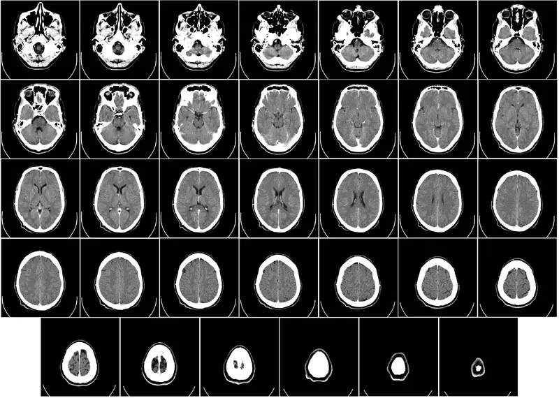 El cerebro humano [Inteligencia colectiva]