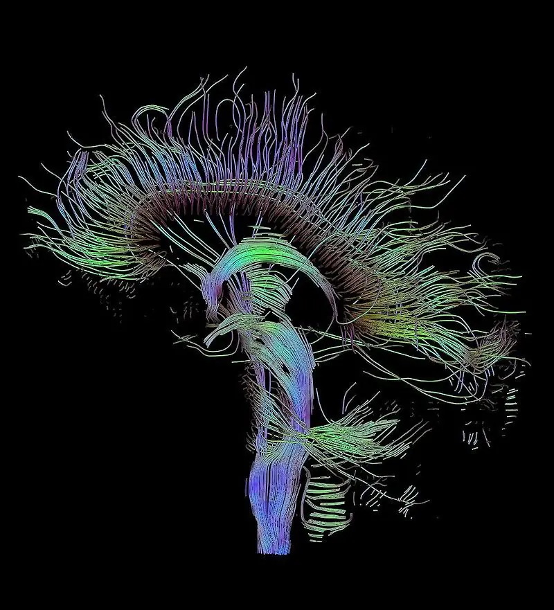 cerebro