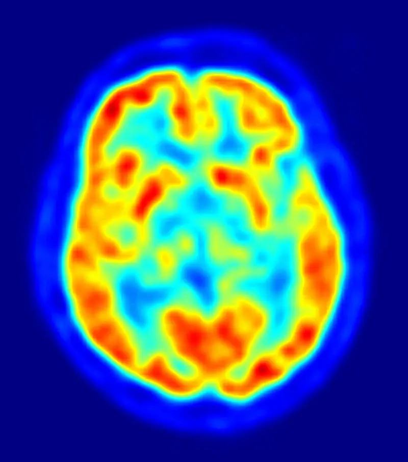 cerebro humano
