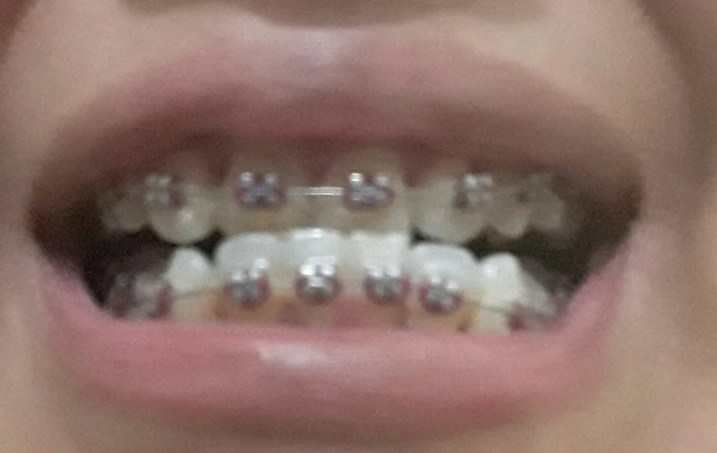 endodoncia