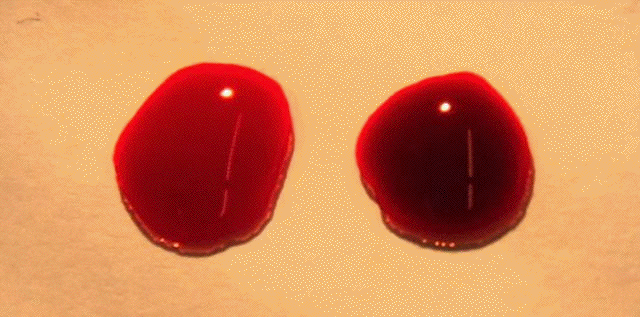 ¿Por qué la sangre es roja?
