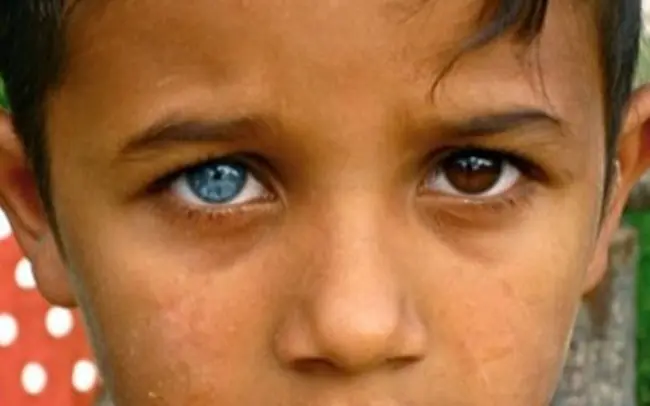 humano