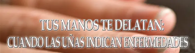 Tus manos te delatan: cuando las uñas indican enfermedades