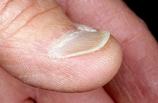 las uñas las uñas