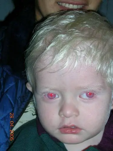 25 curiosidades del ojo humano