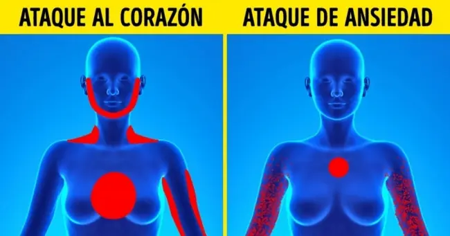 corazon