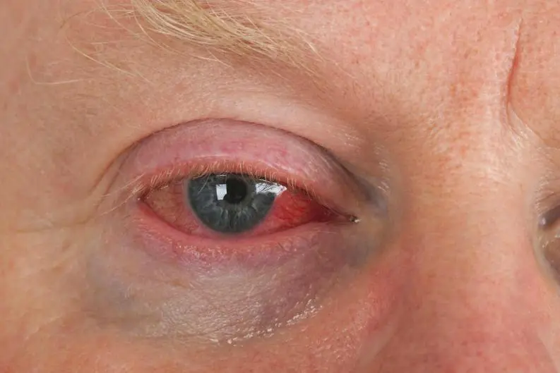 ojos