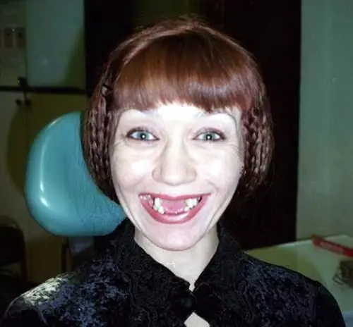 bonitas