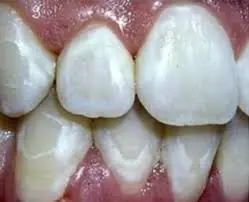 dentifrico