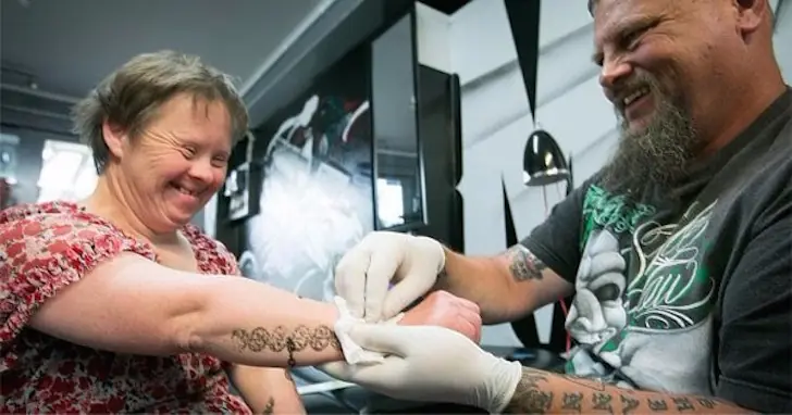 Sindrome de Down