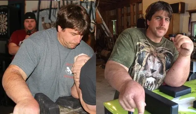 antebrazo