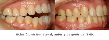 pequenas