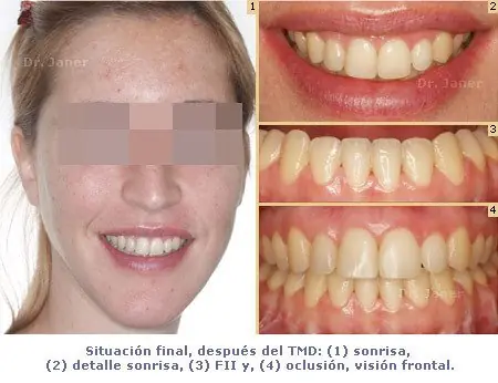 dientes