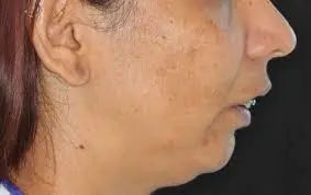 pequenas