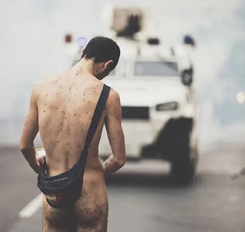 Honor a quien merece; el hombre desnudo.