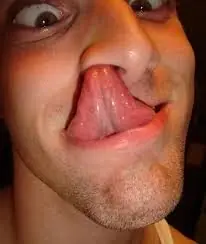 nopueden