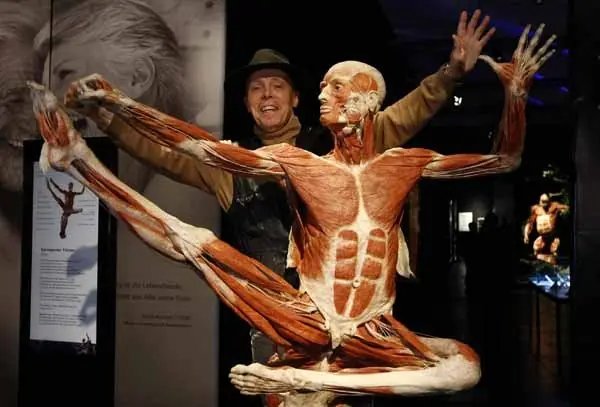 plastinacion