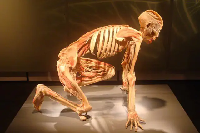 human