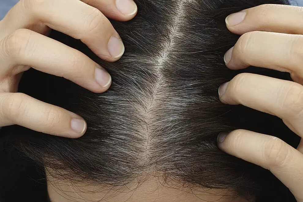5 Razones por las que no debes ignorar las canas precoces 5 Razones por las que no debes ignorar las canas precoces