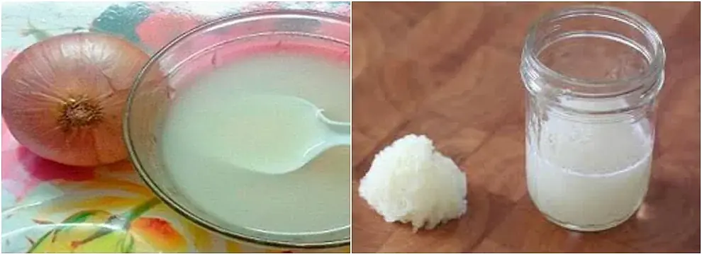 nosabias