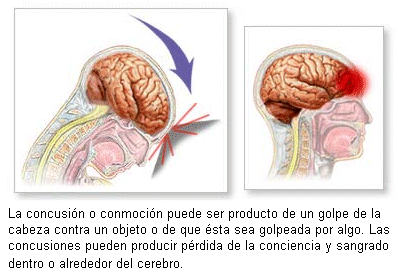 golpes