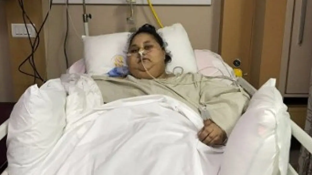 La mujer más obesa del mundo perdió 250 kilos tras operación