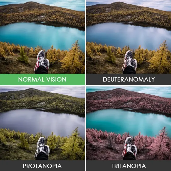 Vision