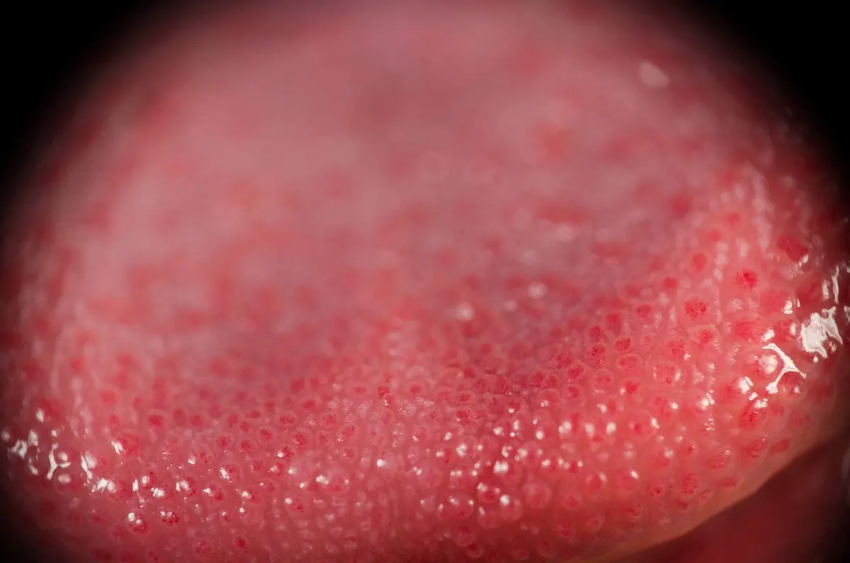 Tu lengua avisa cuando estás apunto de sufrir una enfermedad