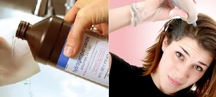 El agua oxigenada y sus mil usos ¡No lo podrás creer!