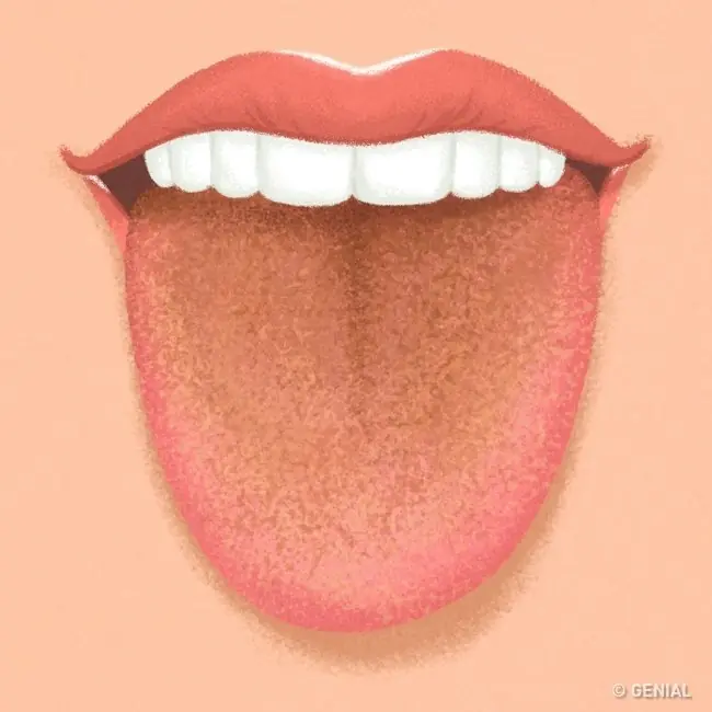lengua