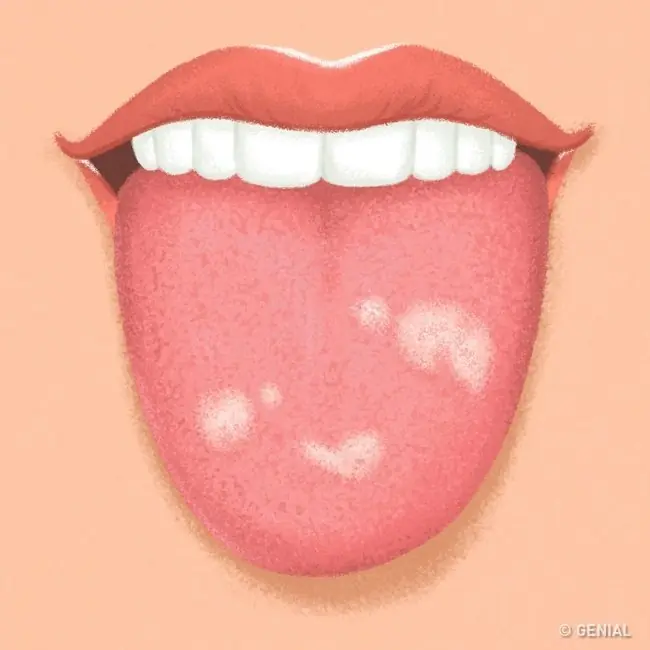 9 Cosas que tu lengua intenta decirte sobre tu salud