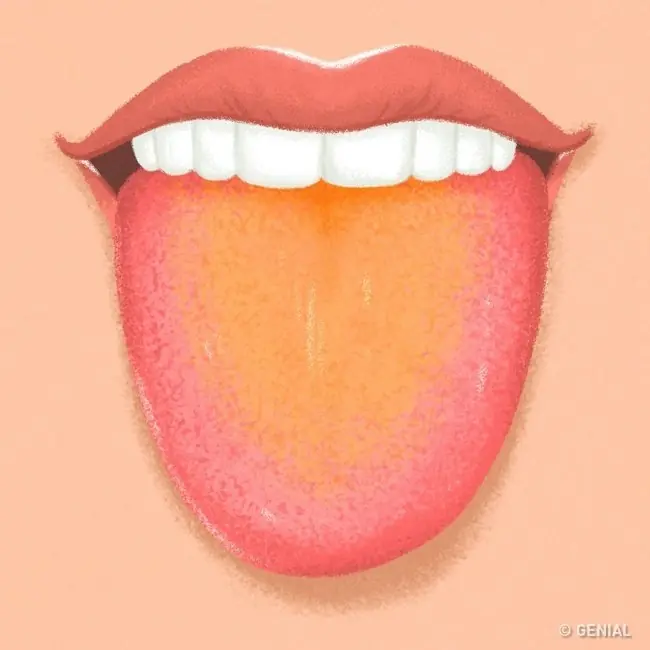 lengua