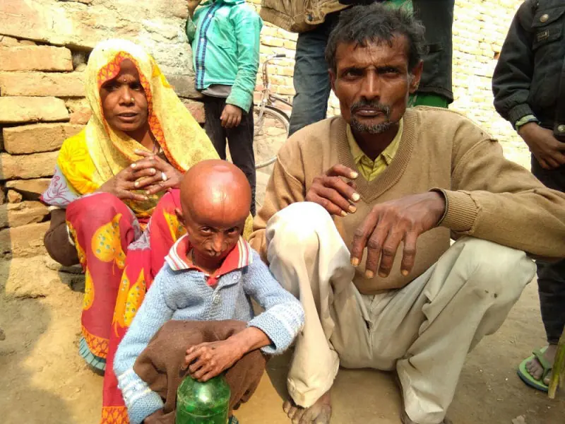 nino con cuerpo de viejo