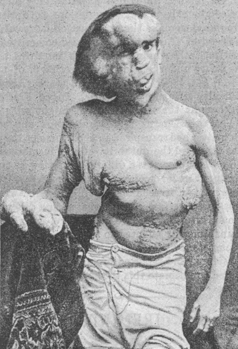 Humanos