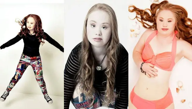 Madeline Stuart, la modelo con sindrome de down