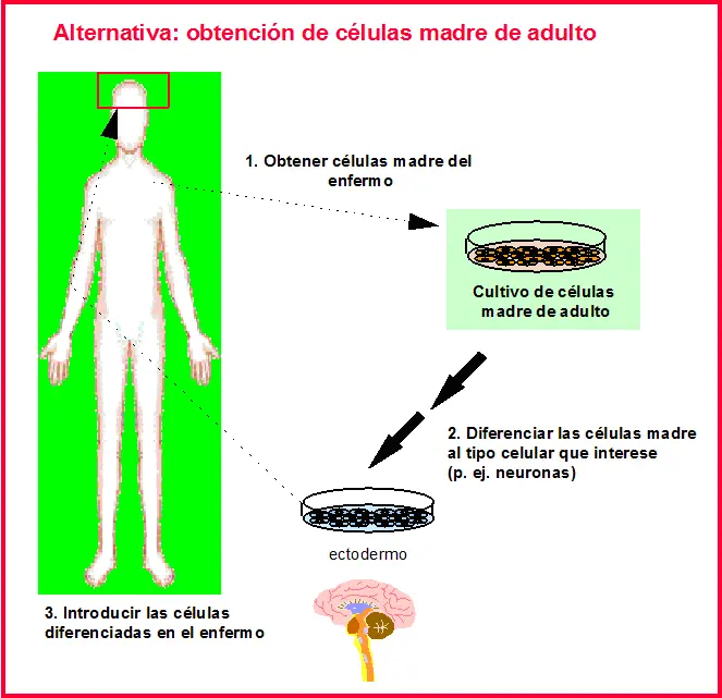 clonaciones