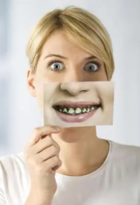 Que pasaria si no me lavo los dientes durante 1 año?