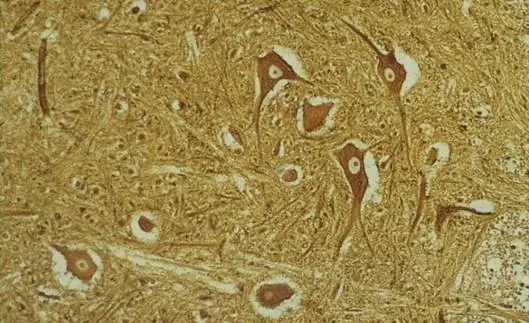 sinapsis