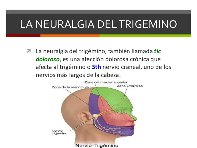 cabeza y cuello